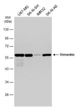 Vimentin Antibody in Western Blot (WB)