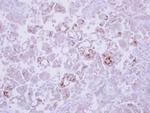 MMP13 Antibody in Immunohistochemistry (Paraffin) (IHC (P))