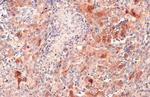 SQSTM1 Antibody in Immunohistochemistry (Paraffin) (IHC (P))