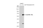 SQSTM1 Antibody in Western Blot (WB)