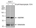 SQSTM1 Antibody in Western Blot (WB)