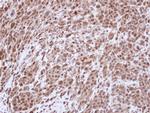 TOP2A Antibody in Immunohistochemistry (Paraffin) (IHC (P))