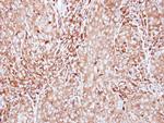 MMP3 Antibody in Immunohistochemistry (Paraffin) (IHC (P))