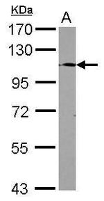 TLR9 Antibody in Western Blot (WB)