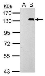 TLR9 Antibody in Western Blot (WB)