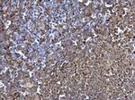 Syk Antibody in Immunohistochemistry (Paraffin) (IHC (P))