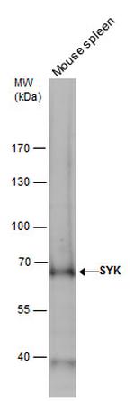 Syk Antibody in Western Blot (WB)