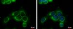 RRM1 Antibody in Immunocytochemistry (ICC/IF)