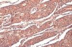 RRM1 Antibody in Immunohistochemistry (Paraffin) (IHC (P))