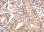 RRM1 Antibody in Immunohistochemistry (Paraffin) (IHC (P))