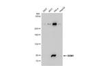 RRM1 Antibody in Western Blot (WB)