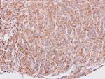 VEGFD Antibody in Immunohistochemistry (Paraffin) (IHC (P))