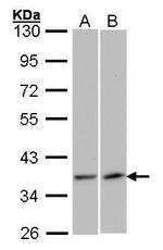 VEGFD Antibody in Western Blot (WB)