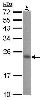 Calmyrin Antibody in Western Blot (WB)