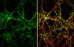 Synaptophysin Antibody in Immunocytochemistry (ICC/IF)