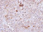 Synaptophysin Antibody in Immunohistochemistry (Paraffin) (IHC (P))