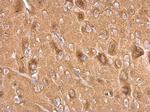 Synaptophysin Antibody in Immunohistochemistry (Paraffin) (IHC (P))