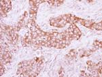 PKLR Antibody in Immunohistochemistry (Paraffin) (IHC (P))