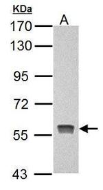 PKLR Antibody in Western Blot (WB)