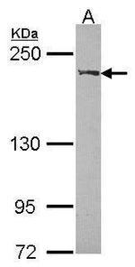 WRN Antibody in Western Blot (WB)