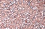 VHL Antibody in Immunohistochemistry (Paraffin) (IHC (P))