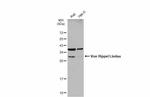 VHL Antibody in Western Blot (WB)