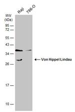 VHL Antibody in Western Blot (WB)