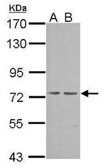 cGKI Antibody in Western Blot (WB)