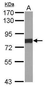 Cytochrome P450 Reductase Antibody in Western Blot (WB)