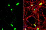 NRG1 Antibody in Immunocytochemistry (ICC/IF)