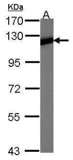 NFkB p100 Antibody in Western Blot (WB)