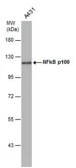 NFkB p100 Antibody in Western Blot (WB)