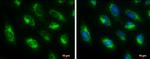 HADHA Antibody in Immunocytochemistry (ICC/IF)