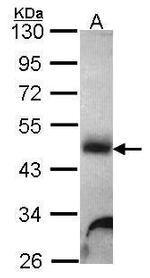 alpha Galactosidase Antibody in Western Blot (WB)