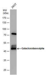 alpha Galactosidase Antibody in Western Blot (WB)