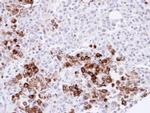 Gelsolin Antibody in Immunohistochemistry (Paraffin) (IHC (P))