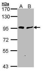 Gelsolin Antibody in Western Blot (WB)