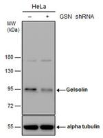 Gelsolin Antibody