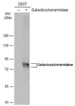 GALC Antibody in Western Blot (WB)