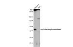 GALC Antibody in Western Blot (WB)