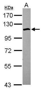 SCP1 Antibody in Western Blot (WB)