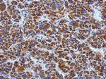 DLD Antibody in Immunohistochemistry (Paraffin) (IHC (P))