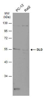 DLD Antibody in Western Blot (WB)