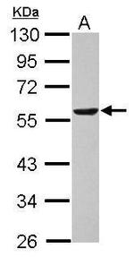 DLD Antibody in Western Blot (WB)