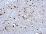 HMGB1 Antibody in Immunohistochemistry (Paraffin) (IHC (P))