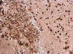 MEF2A Antibody in Immunohistochemistry (Paraffin) (IHC (P))