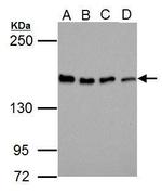 Blooms Syndrome Antibody in Western Blot (WB)