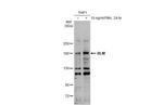 Blooms Syndrome Antibody in Western Blot (WB)