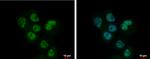 Adenosine Kinase Antibody in Immunocytochemistry (ICC/IF)