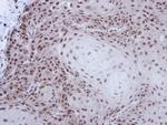 NONO Antibody in Immunohistochemistry (Paraffin) (IHC (P))